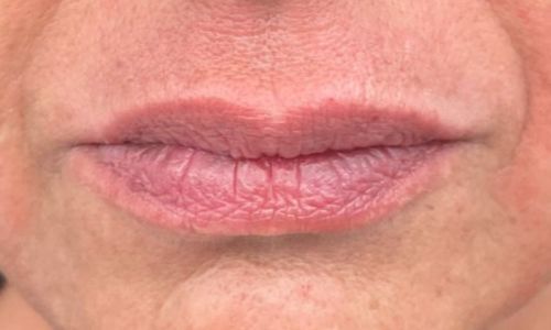 Codice a barre dopo 1