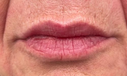 Codice a barre dopo 2